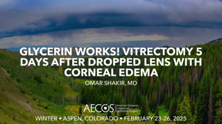 Glycerin works! Vitrectomy 5 days after dropped lens with corneal edema